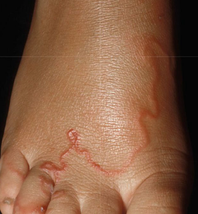 <p>what shape/arrangement and condition is depicted</p>