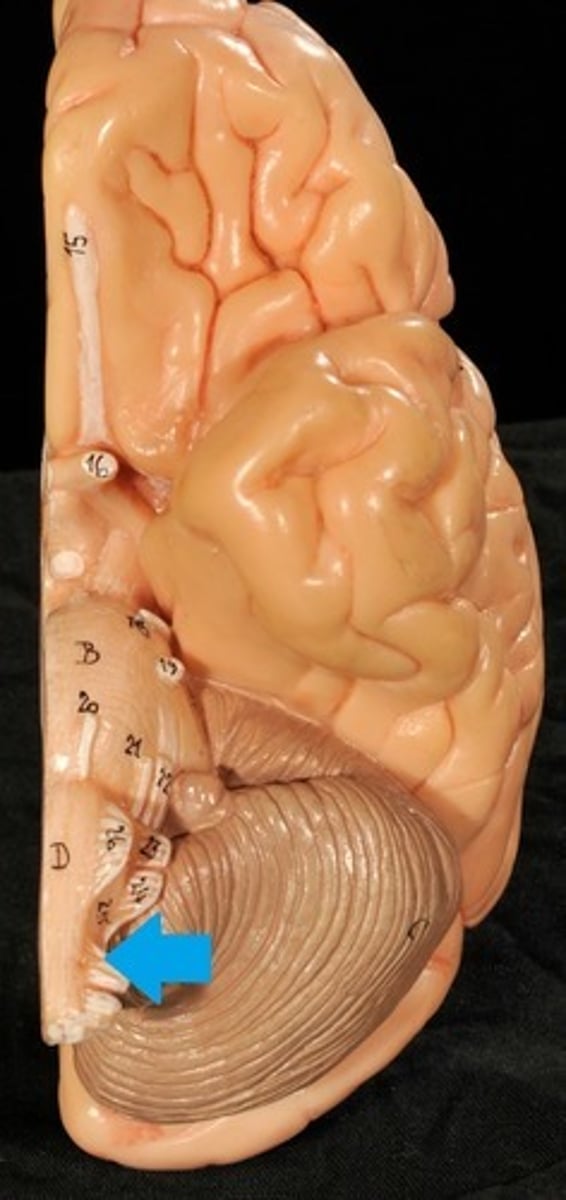 <p>Motor: Neck and Upper back</p>