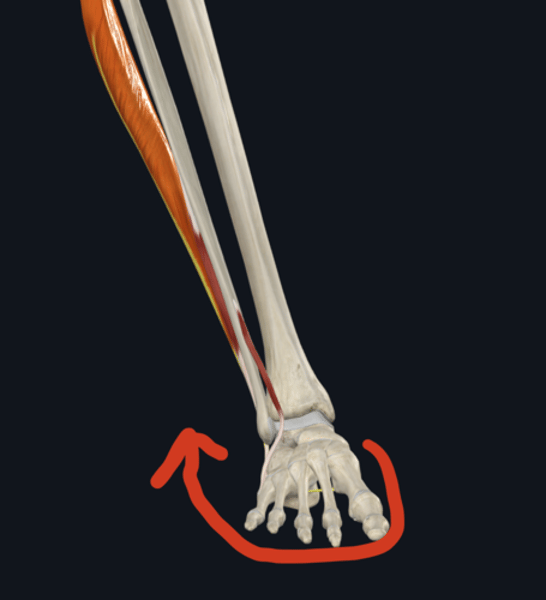 <p>Action: Peroneus Longus</p>