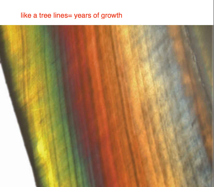 <ul><li><p>the striae of Retzius are incremental growth lines or bands</p><p>seen in tooth enamel. </p></li><li><p>They represent the incremental pattern of enamel (like a tree), the successive apposition of different layers of enamel during crown formation</p></li></ul><p></p>