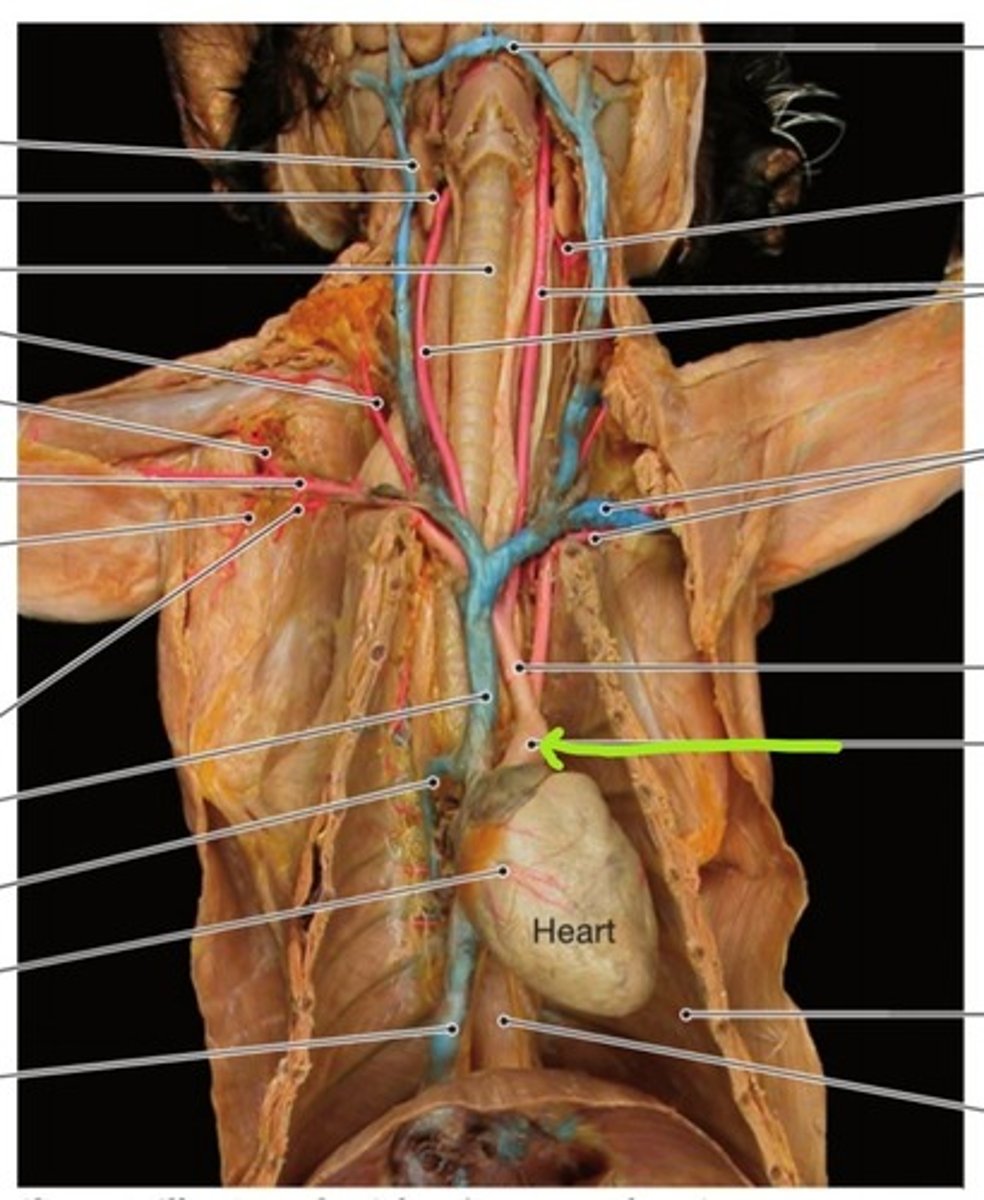<p>identify this artery</p>