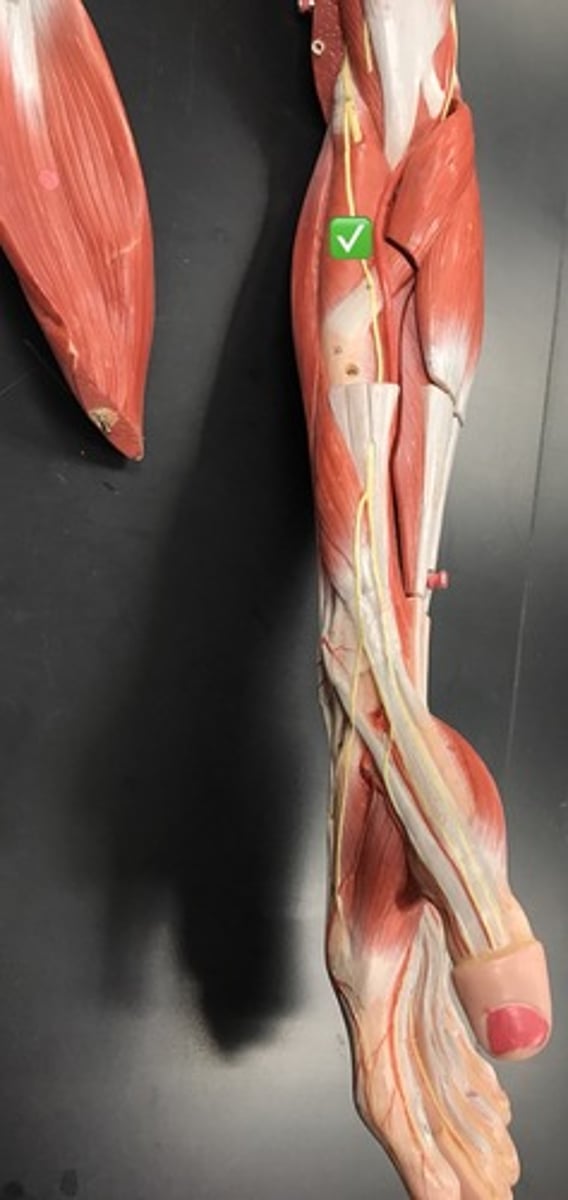 <p>Origin: Lateral epicondyle of humerus</p><p>Insertion: Radius</p><p>** short muscle on same level as flexor digitorm superficialis</p>