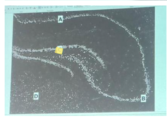 <p>Which of these is the location of the subgranular zone of the dentate gyrus ?</p><ol><li><p>A</p></li><li><p>B</p></li><li><p>C</p></li><li><p>D</p></li></ol><p></p>
