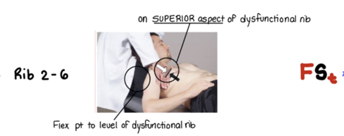 <p>F St</p><p>MCP on superior aspect of rib - resisting with INHALATION, following into EXHALATION</p><p>Flex pt to level of dysfunctional rib</p>