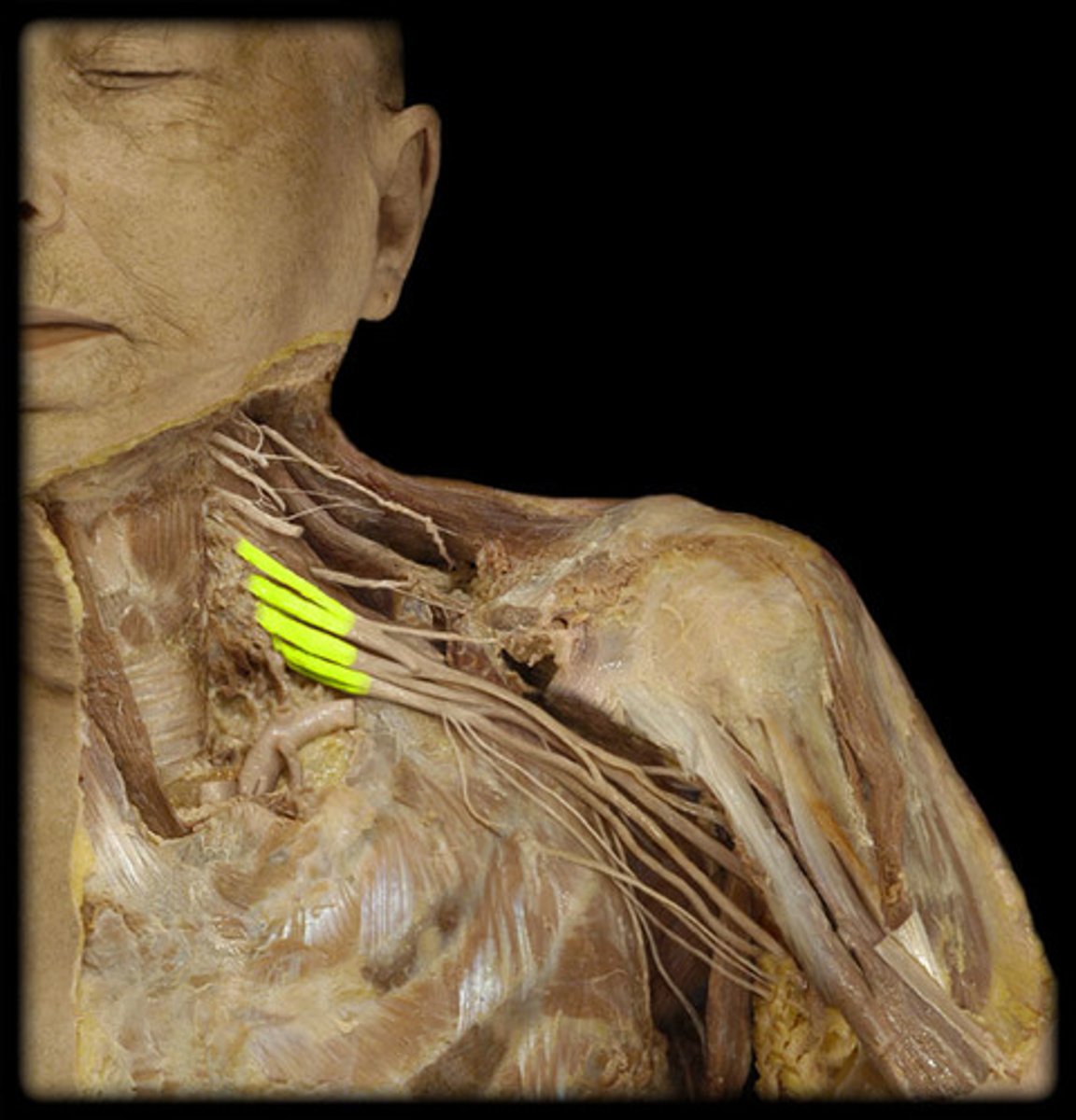 <p>Name the Nerves</p>
