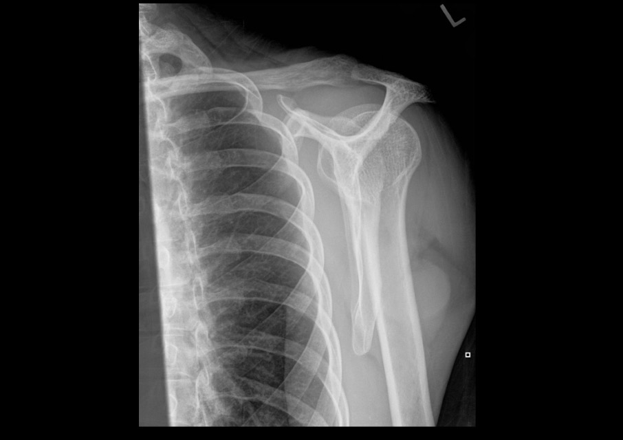 <p>What projection position is this image?</p>