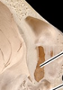 <p>What is the name of this bone in the skull?</p>