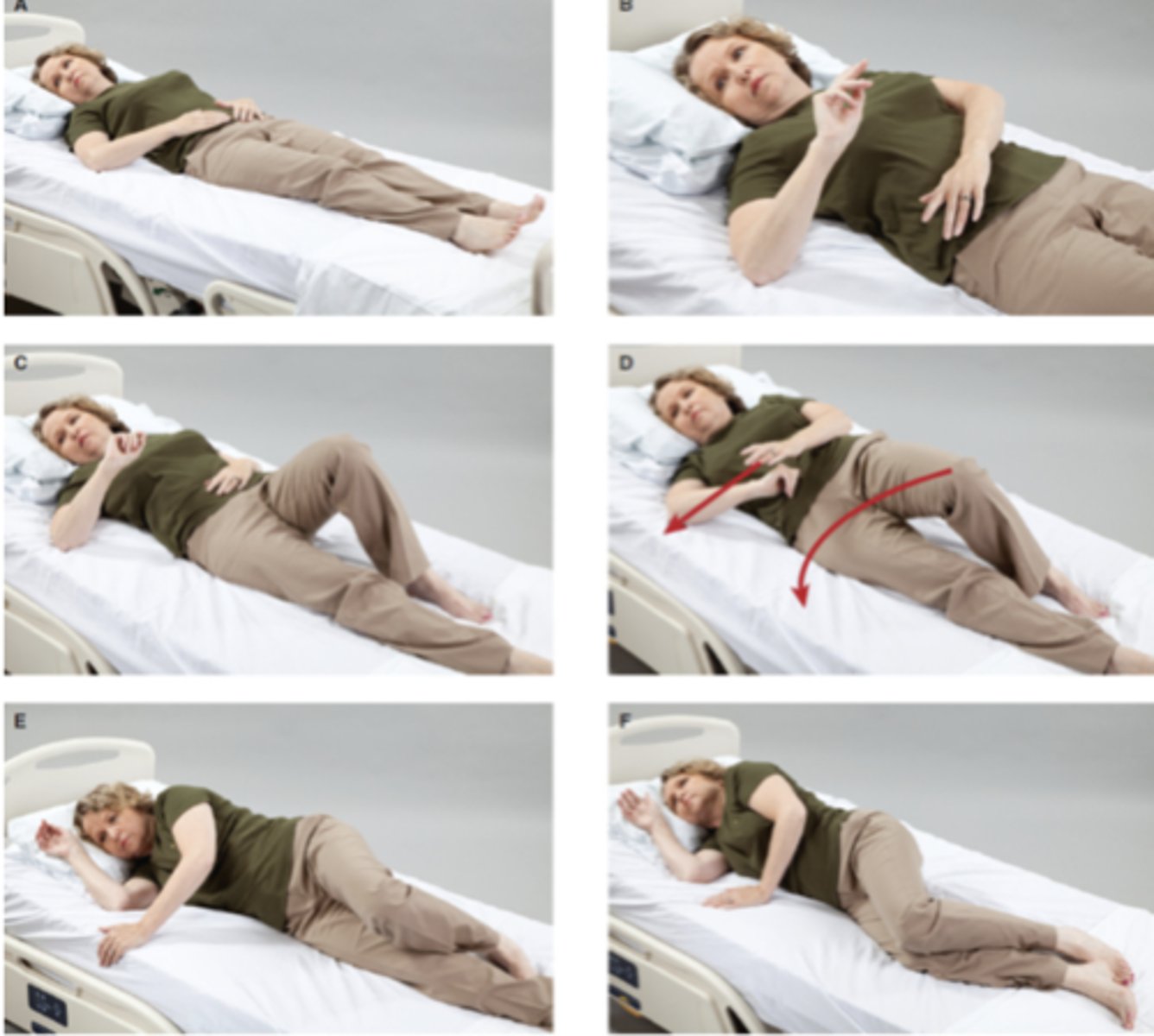 <p>(A) The patient initiates the movement by turning the eyes and head; the patient's trunk will naturally follow the head.</p><p>(B) Abducting the right shoulder provides stability during the roll and places the arm in a good position for when sidelying is completed.</p><p>(C) Bend the knee opposite the direction of the turn; if going to the right, bend the left knee and vice versa.</p><p>(D) Reach across the body, and use the foot of the bent leg to push the trunk into sidelying.</p><p>(E) The roll from supine to sidelying is complete.</p><p>(F) Finish the positioning with trunk sidelying and extremities in a position of comfort.</p>