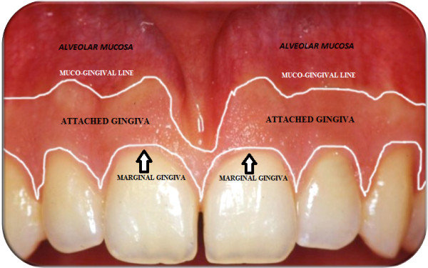 <p>Mucogingival junction</p>