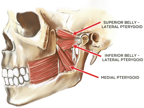 <p>Responsible for lateral movement of the mandible, located deep in the jaw.</p>