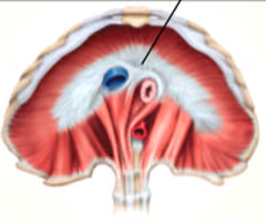 insertion of diaphragm