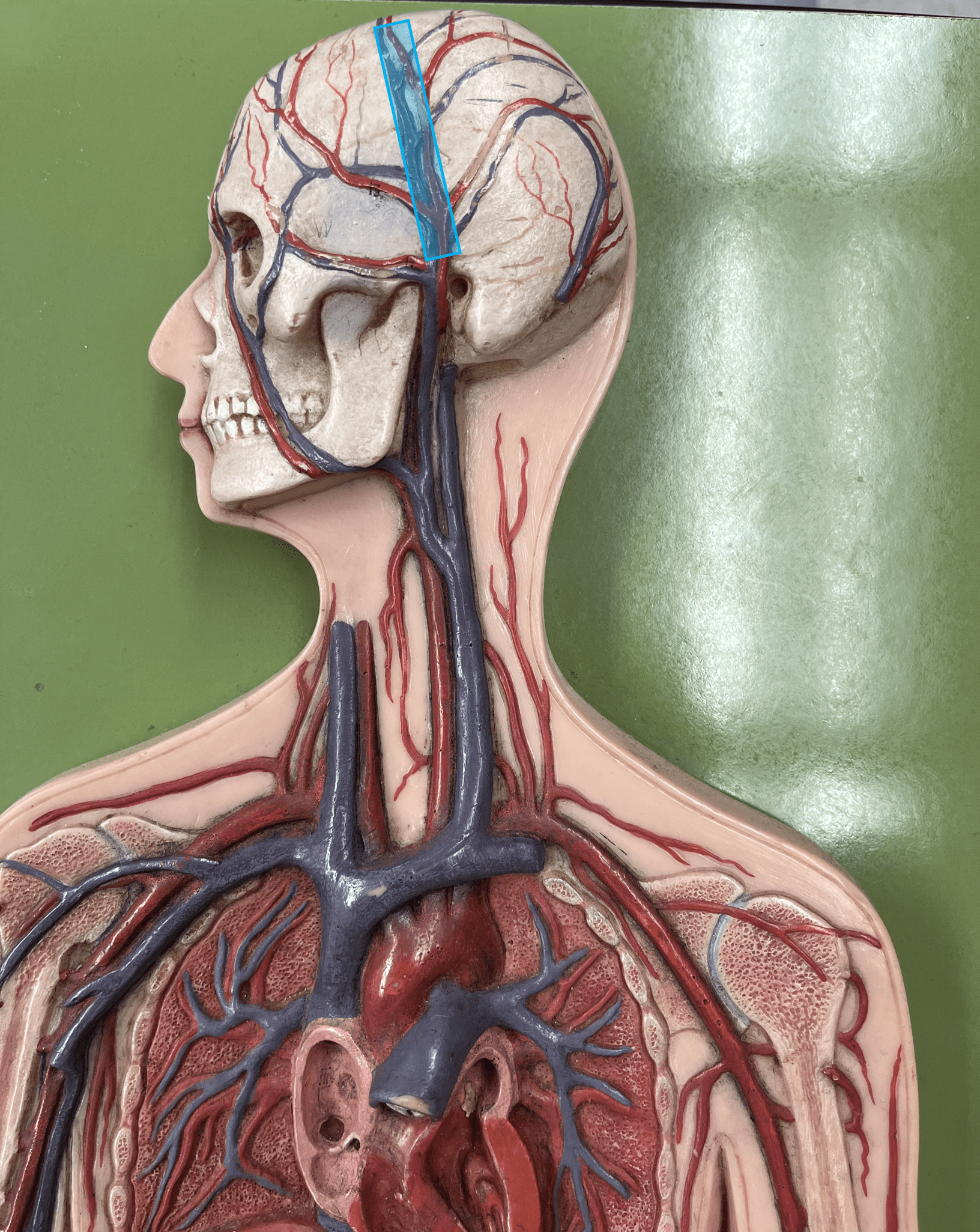 <p>• A vein of the head and neck.</p>
<p>• Drains the chewing muscles and scalp.</p>
<p>• Empties into the internal jugular vein.</p>