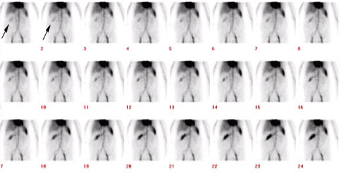 <p>what is this picture showing and is this using Tc-RBC’s or Tc-SC?</p>