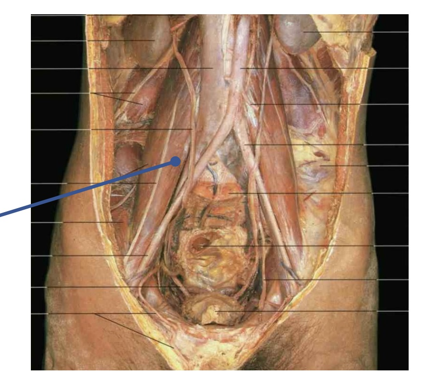 <p><span>An injury to this muscle would primarily weaken what action in the afflicted individual?&nbsp;</span></p>