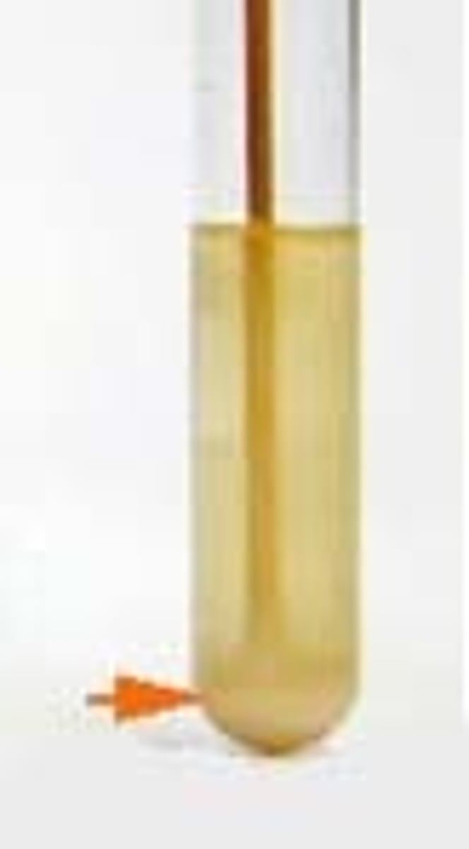 <p>settlement at the bottom of the liquid media</p>