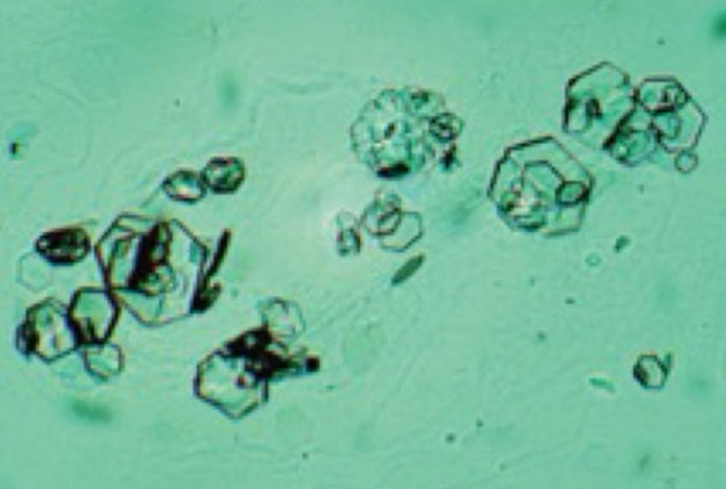 <p>Colorless hexagons, seen in patients with cystinuria</p>