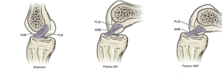 <ol><li><p><span style="background-color: transparent;"><span>During extension, the bands are not fully taught . the plb is taught wile the amb is relaxed</span></span></p></li><li><p><span style="background-color: transparent;"><span>During flexion the amb is taught witle the plb is relaxed ish</span></span></p></li><li><p><span style="background-color: transparent;"><span>Further you go into flexion = the more taught the amb = more instability since the knee is less articulated with the</span></span></p></li></ol><p></p>