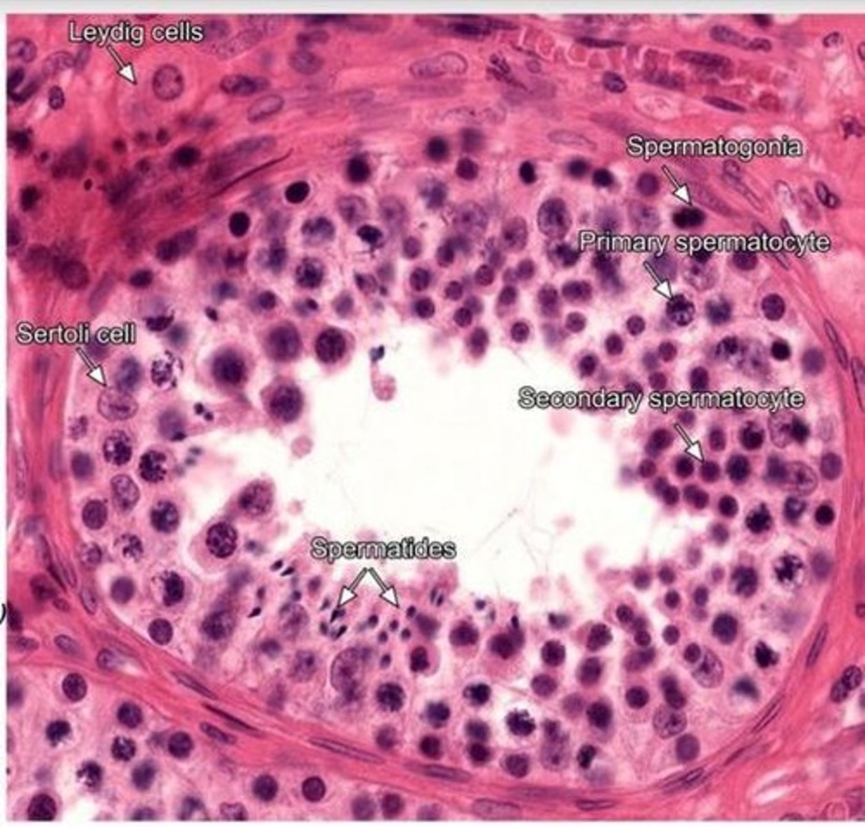 <p>Testosterone stimulates the Wolffian ducts to develop into male internal organs and external genitalia.</p>