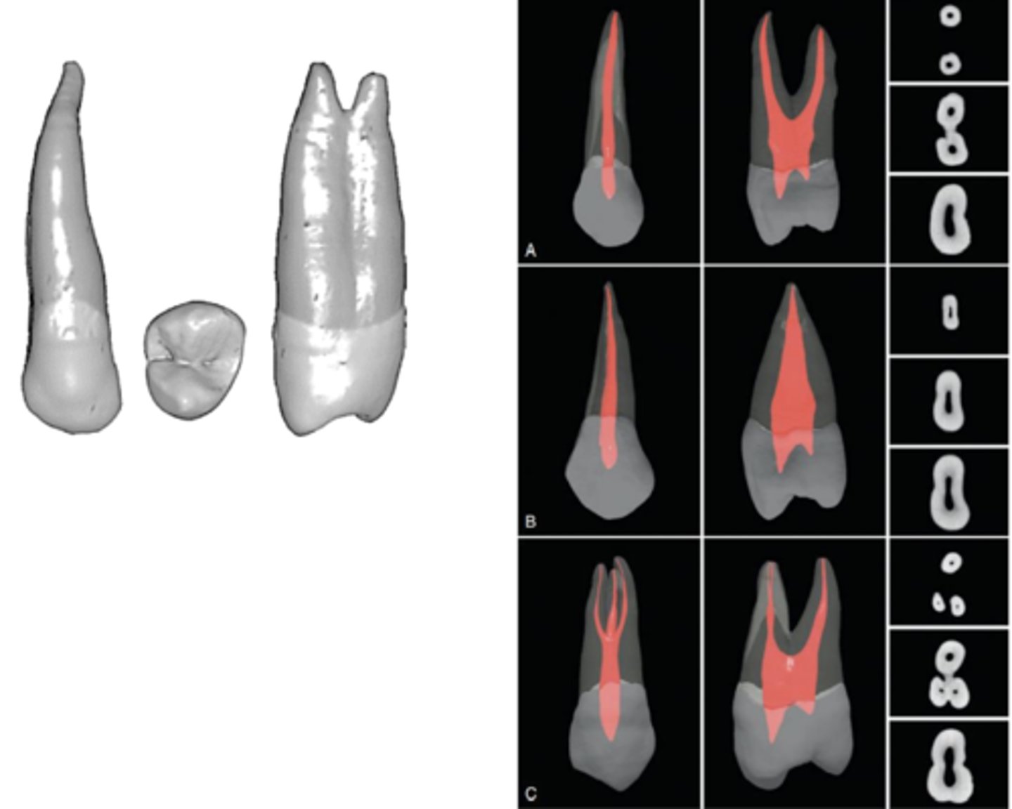 <p>maxillary 1st premolar</p>