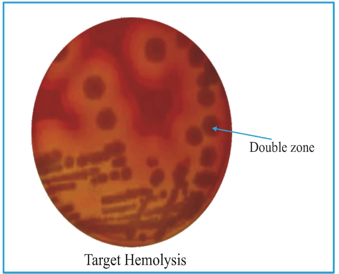 <p>Double zone of hemolysis.</p><p>Inner complete part is due to theta toxin</p><p>Outer incomplete part is due to alpha toxin</p><p></p>
