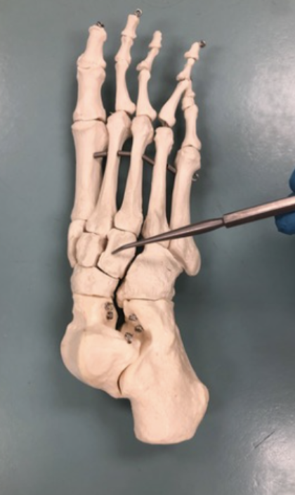 <p><span style="font-family: -apple-system, system-ui, Segoe UI, Roboto, Helvetica Neue, Arial, Noto Sans, Liberation Sans, sans-serif, Apple Color Emoji, Segoe UI Emoji, Segoe UI Symbol, Noto Color Emoji">Identify this bone.</span></p>