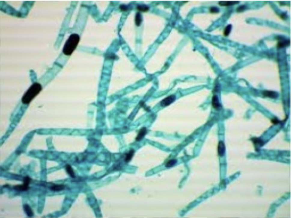 Spirogyra (vegetative)