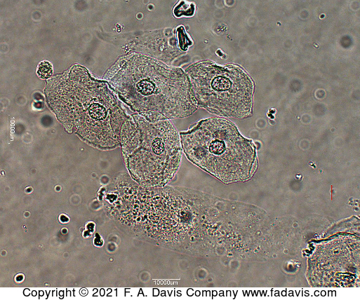 <p>name this cell? What is it associated with?</p>