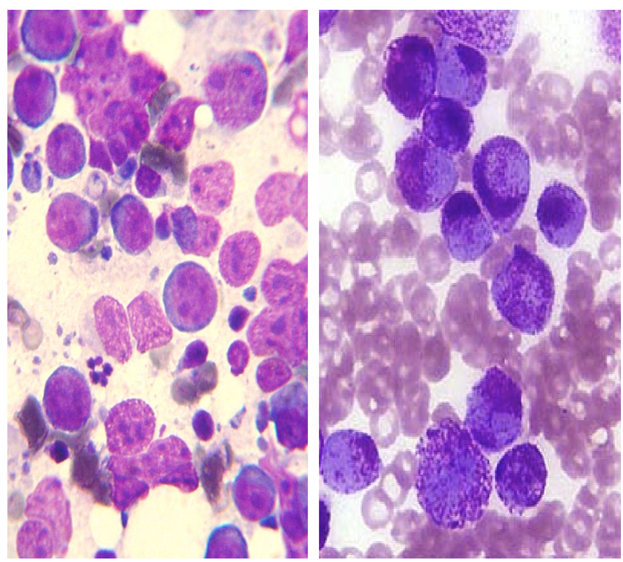 <ul><li><p>plasma cell </p></li><li><p>lymphoma </p></li><li><p>mast cell </p></li><li><p>histiocytoma </p></li><li><p>transmissible venereal tumor </p></li><li><p>± melanoma </p></li><li><p>discrete small to medium sized cells </p></li></ul><p></p>