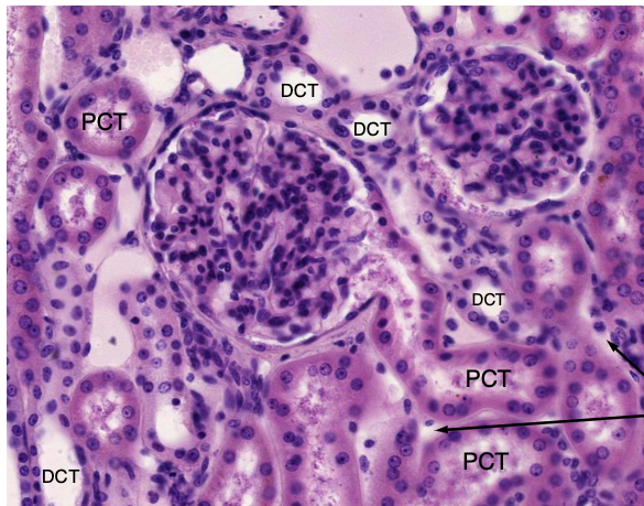 <p>which convoluted tube has a brush border and abundant mitochondria?</p>