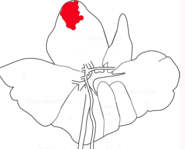 <p>Describe this distribution</p>