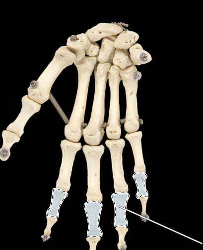 <p>Bones of the hand, overview, anterior view, right side</p>