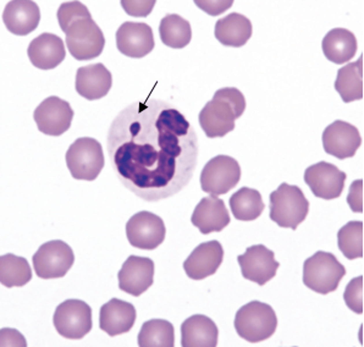 <p>The arrow in the image is pointing to what structure? What does this imply?</p>