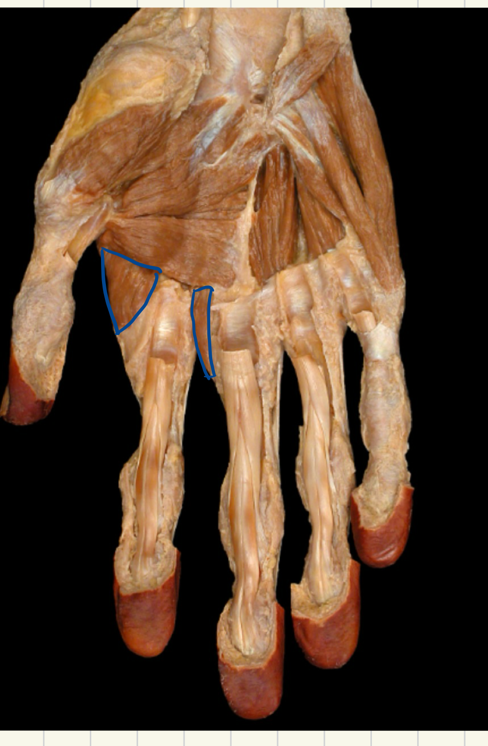 <p>What muscle is this?  ( Origin, insertion, action, and innervation)</p>