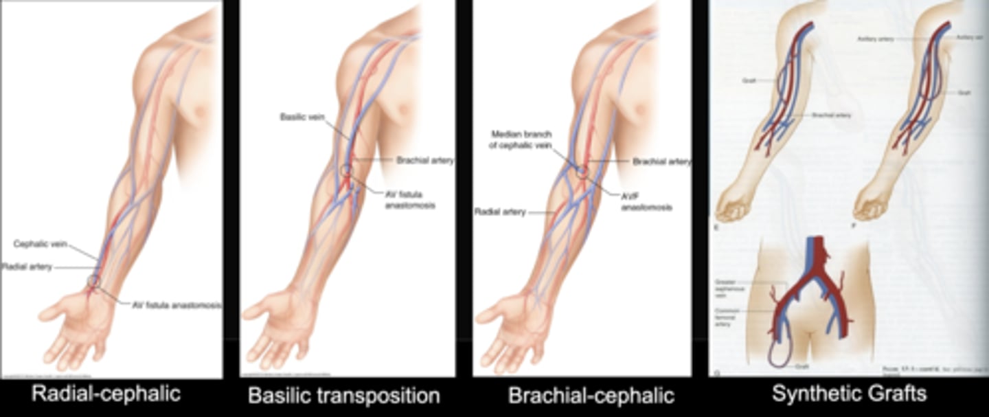 <p>Non dominant forearm</p><p>Dominant forearm</p><p>Non dominant upper arm</p><p>Dominant upper arm</p><p>Lower extremity</p>