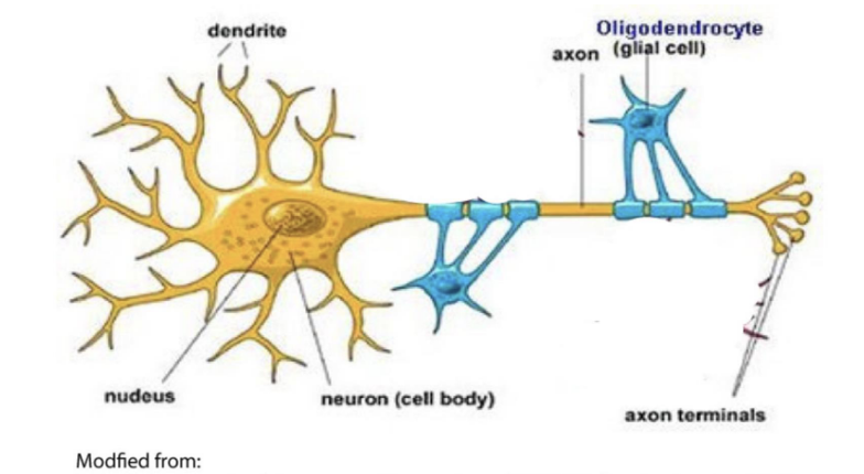 <ul><li><p>MS affects the CNS</p></li><li><p>part of family of diseases the involve the <u>lack of myelin</u></p></li><li><p>myelin insulates the axons of nerves</p></li><li><p>oligodendrocytes = cells that produce myelin</p></li><li><p>patients’ immune system attacks the myelin sheaths surrounding nerve fibers → leads to breakdown in the transmission of nerve signals</p></li><li><p>symptoms can range from numbness to blindness and paralysis</p></li><li><p>current treatments often involve immunosuppression</p></li><li><p>treatment = effective but usually temporary</p></li></ul><p></p>