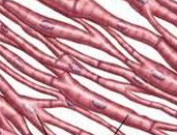 <p>What kind of muscle is pictured here?</p>