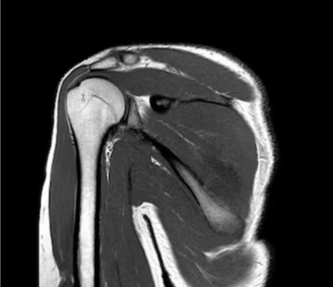 <p>What type of view is this? Anterior vs. posterior? How do you know?</p>