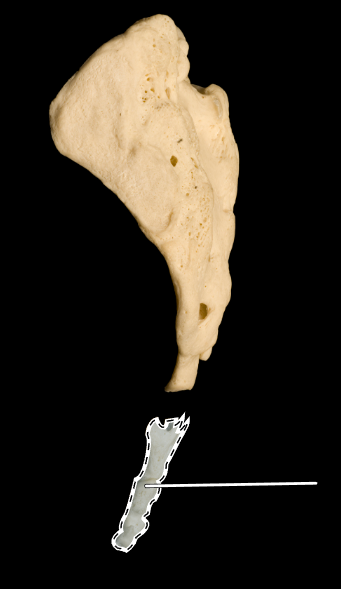 <p>What is the highlighted bone called?</p><p>(Lateral view).</p>