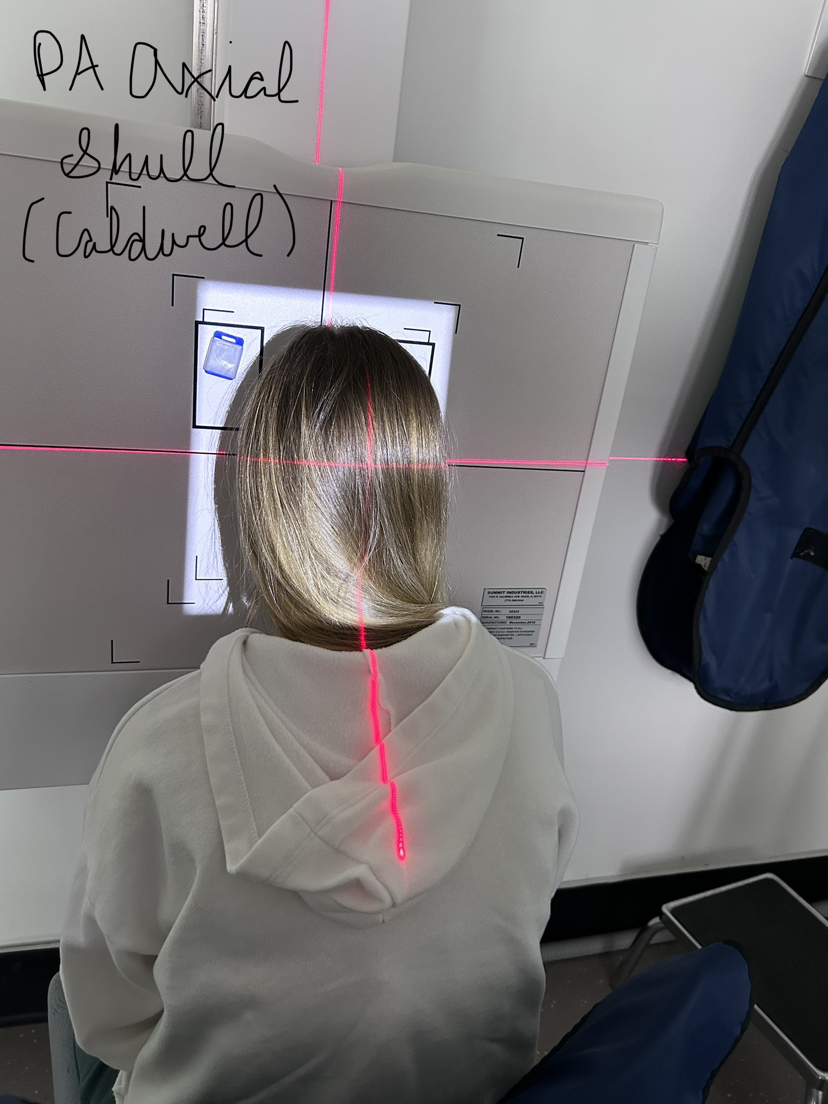 PA Axial Skull (Caldwell)