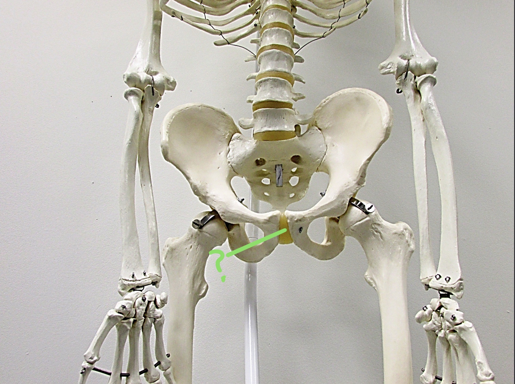 <p>Determine the part of the Coxa/Sacrum highlighted</p>