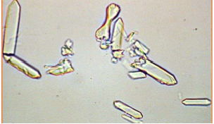 <p>Name the crystal</p>