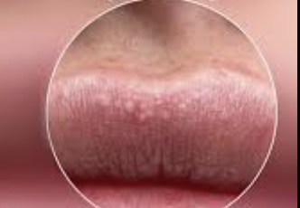 <p>What is on the lip</p>