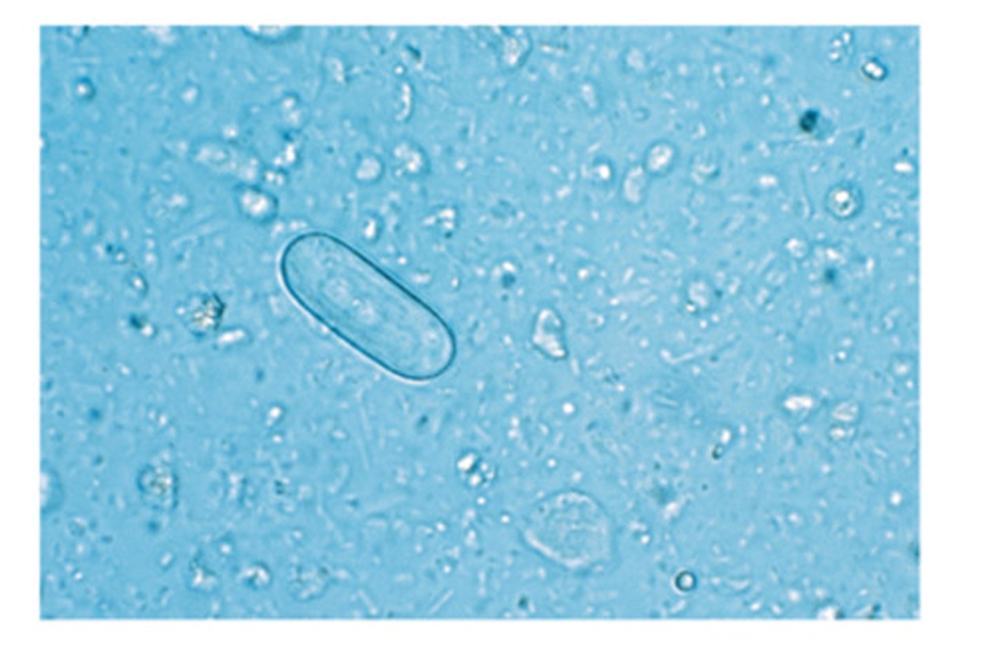<p>The nematode ovum of this parasite is characteristically thick-shelled and "paper clip" shaped</p>