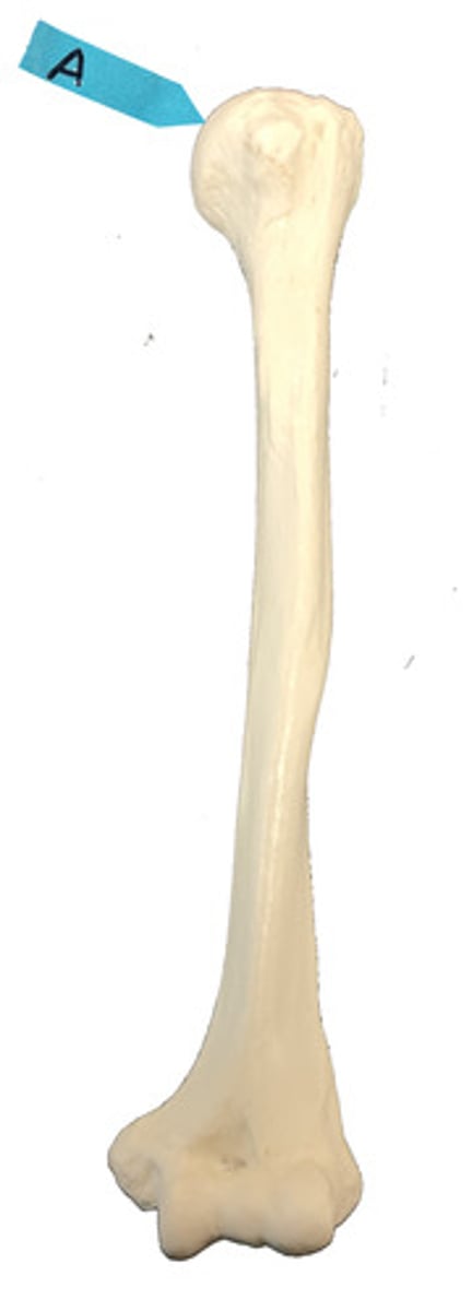 <p>Identify this bone marking.</p>