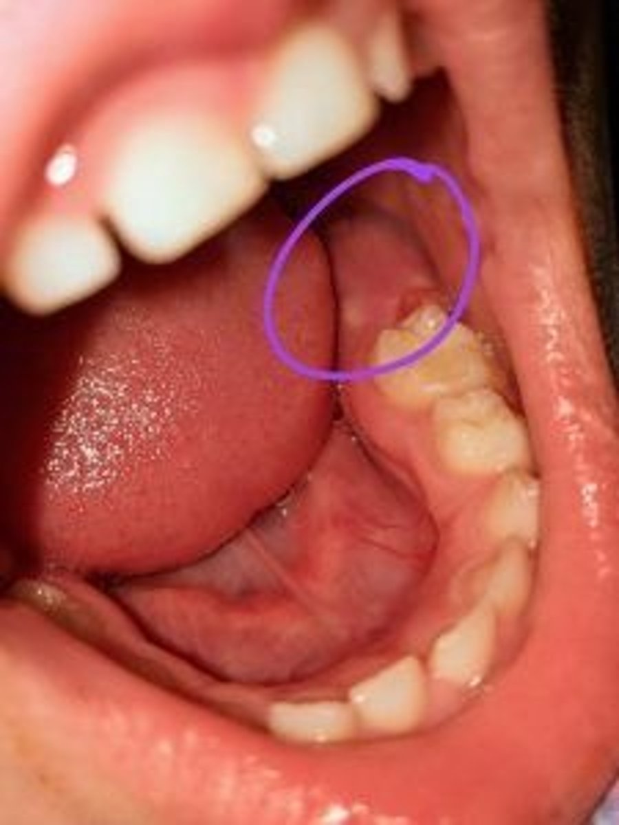 <p>Tooth #19 forms within the mandible (prior to erupting) at which location?</p>