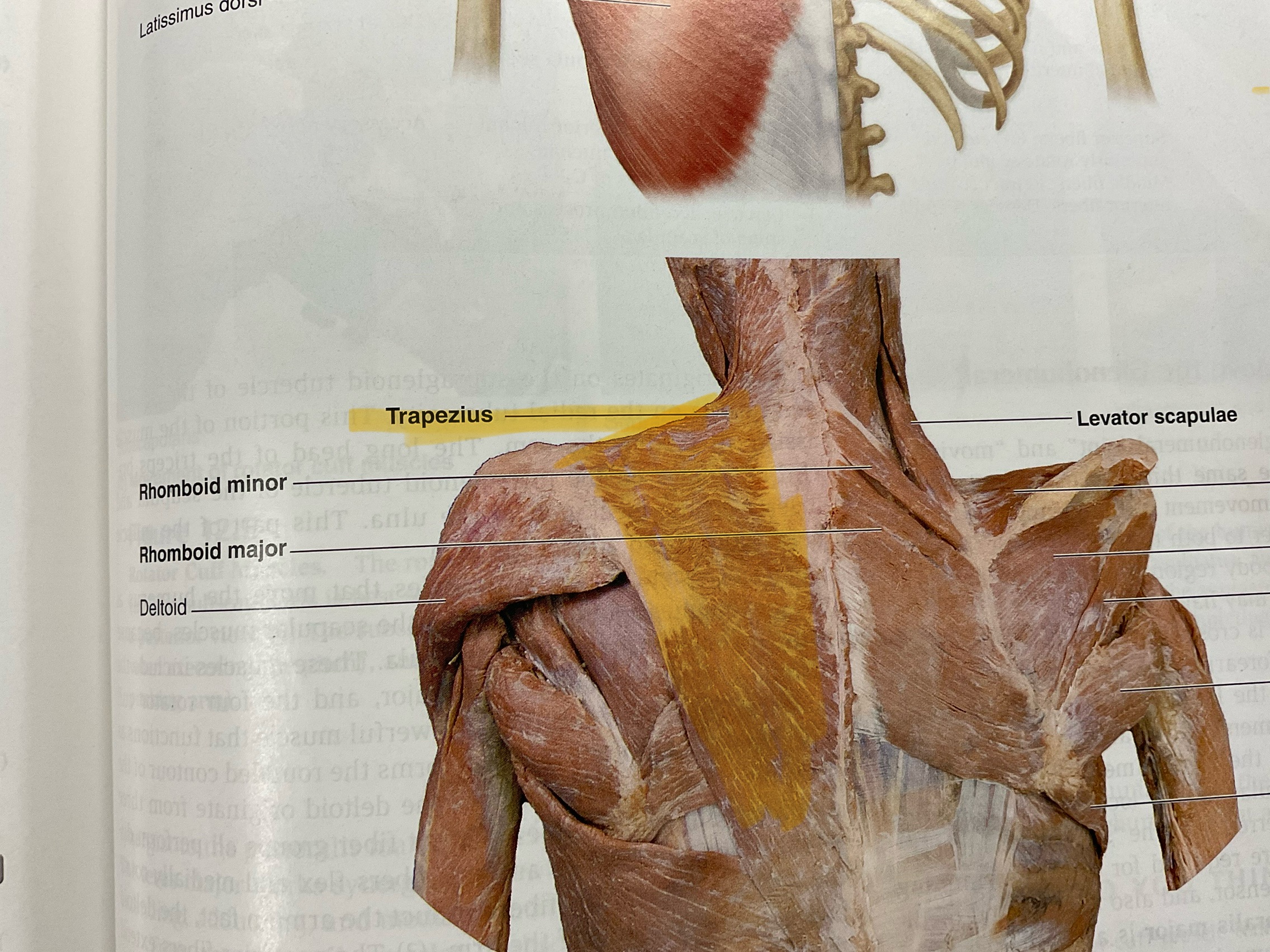 <p>Action: elevates, adduct(closest to midline), stabilizes scapula; extend neck</p>