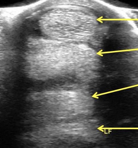 <p>label equine distal limb ultrasound (top to bottom)</p>
