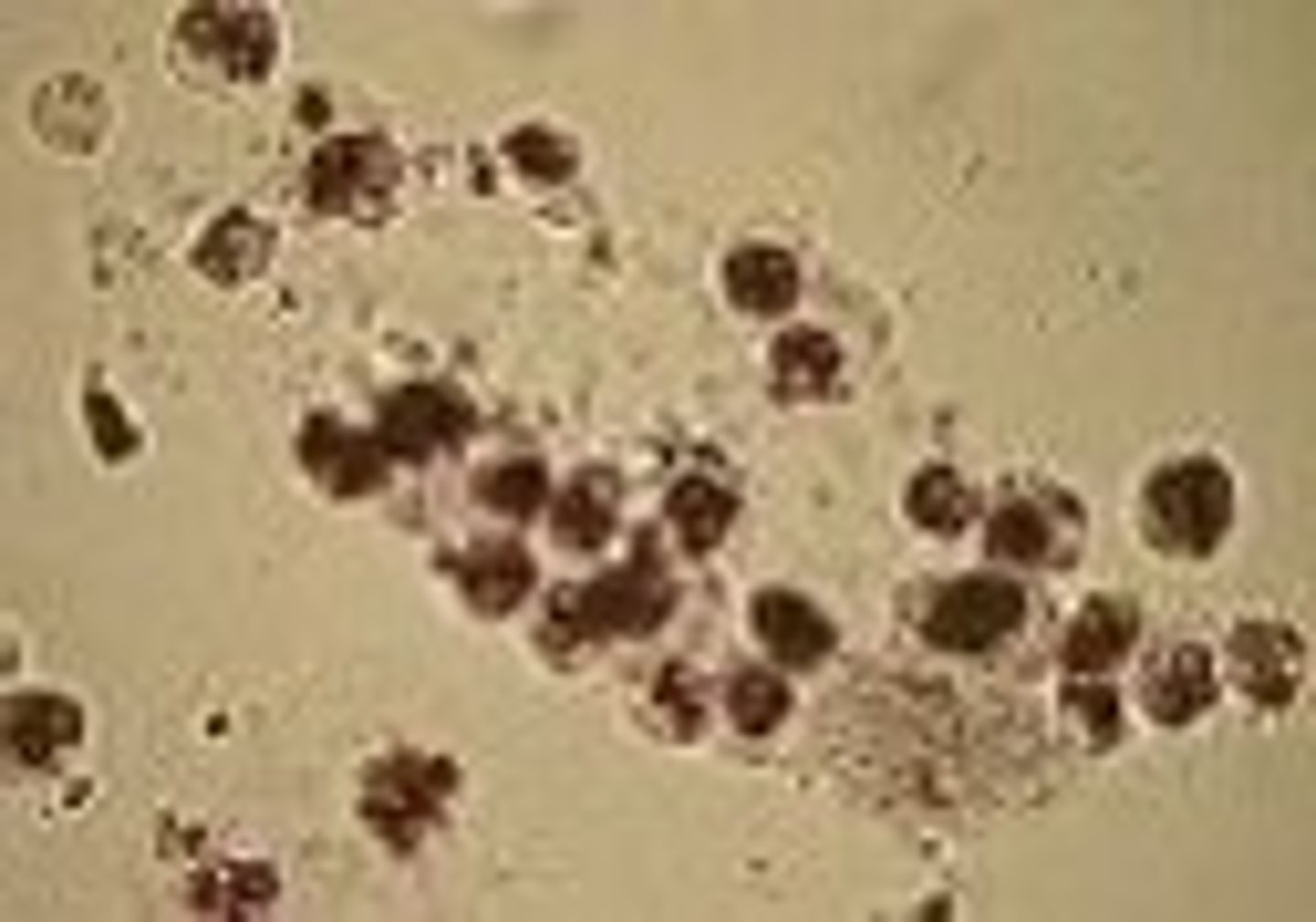 <p>Bacilli bound to protein matrix</p><p>-sources of error= granular casts</p><p>-reported= avg. number per lpf</p><p>-correlations= WBCs, LE, nitrite, protein, bacteria</p>