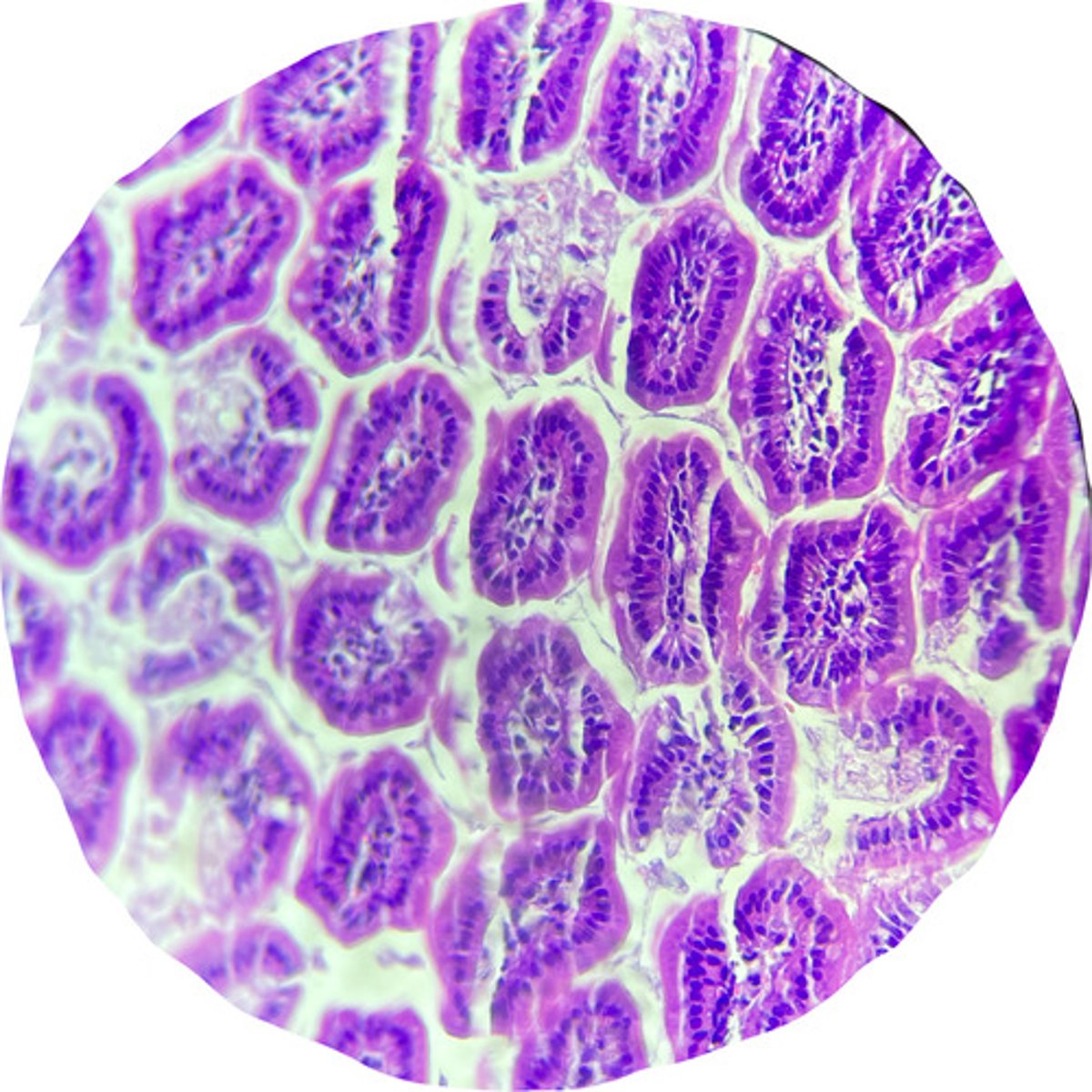 <p>in the small intestine, what are these structures? what type of epithelial lining surrounds them?</p>