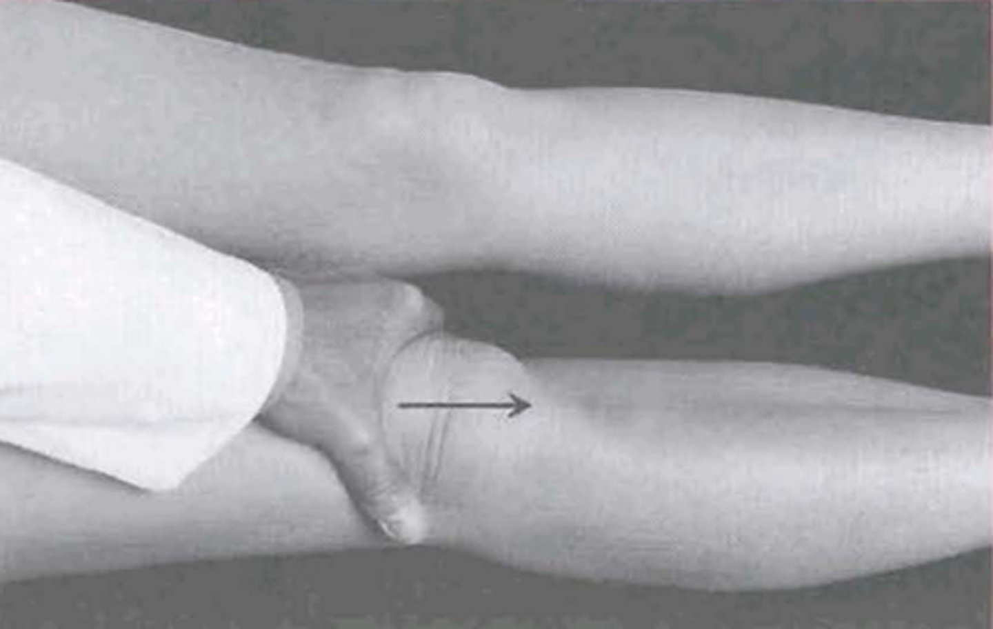 <p>what PFPS test is being performed?</p>